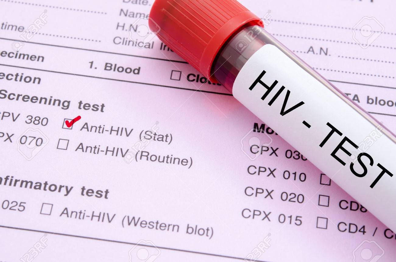 Sample blood collection tube with HIV test label. BOHOL ISLAND NEWS