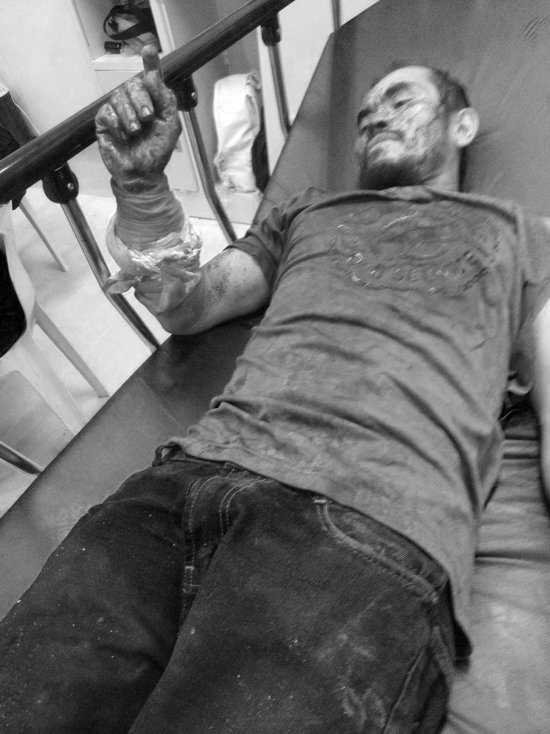 Man survives snake attack in Bohol